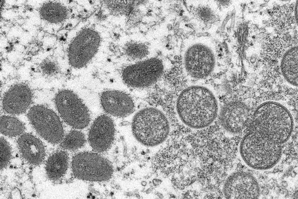 지난 5월 미국 질병통제예방센터가 공개한 원숭이두창 바이러스. /AP=뉴시스